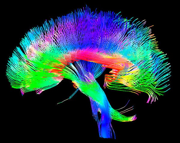 Neuroscienze, l'immagine di un cervello ripresa da una tac