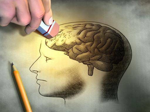 Alzheimer, una gomma cancella il disegno del cervello umano