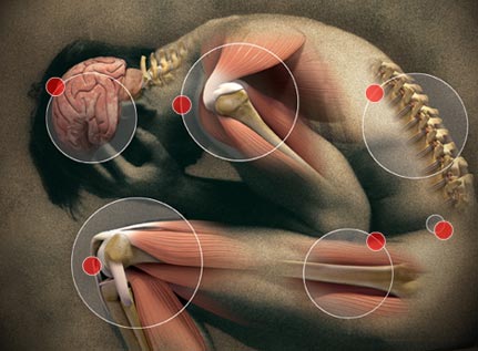 Fibromialgia, un'immagine modificata in grafica mostra le articolazioni di un uomo in posizione rannicchiata