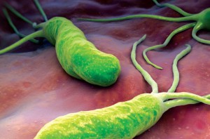 Gli helicobacter pylori possono causare il tumore