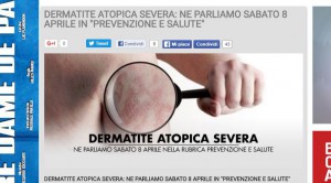 dermatite atopica severa, la locandina del portale di radio kiss kiss Italia