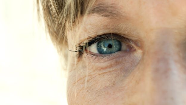 cecità: occhio di donna