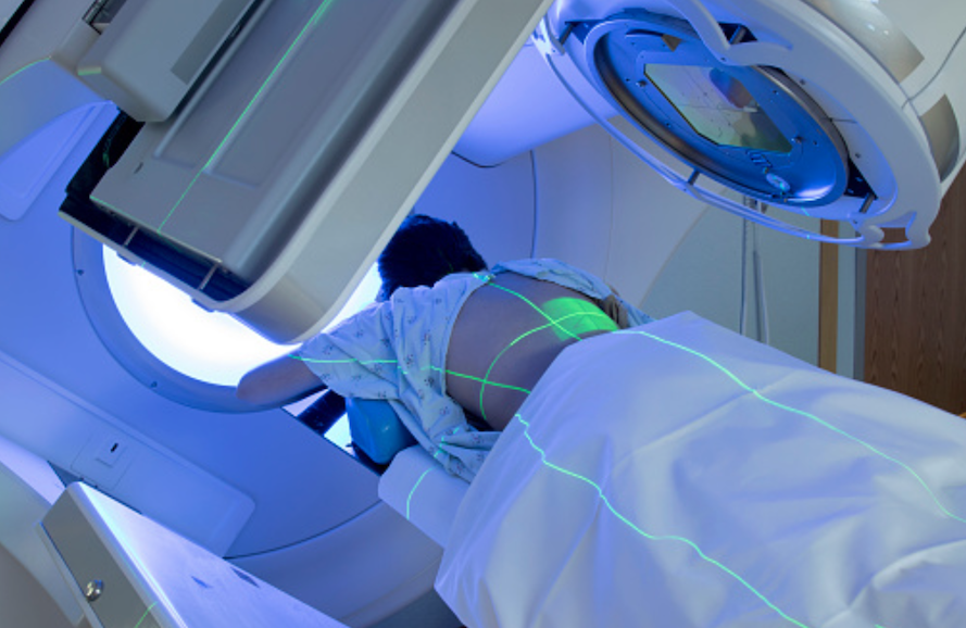 Radioembolizzazione, una seduta di radioterapia